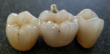 All On Four Dental Implants Long Island business image